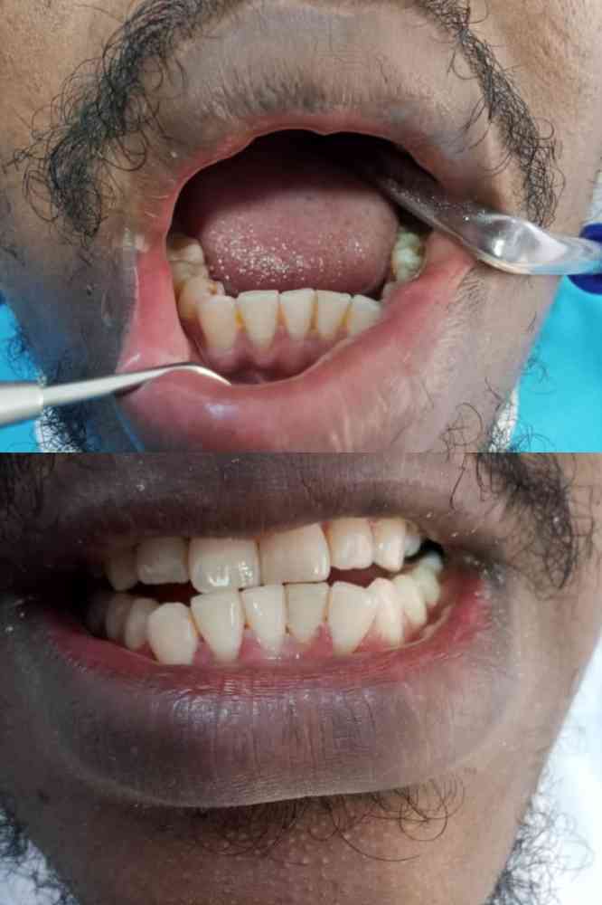 Novacare Dental & Maxillofacial Surgery
